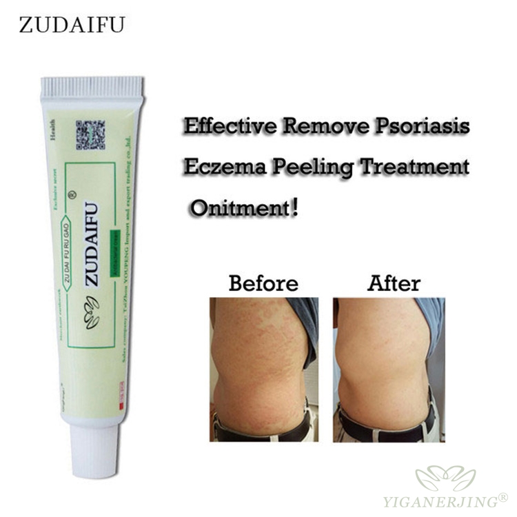 High Quality Chinese Herbal Skin Disease Cream Zudaifu Relieve Itching