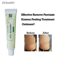 Chinese Herbal Skin Disease Cream Zudaifu Relieve Itching 15g Antibacterial Ointment Psoriasis Ointment