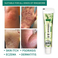 Zudaifu Skin Care Cream Skin Psoriasis Cream Dermatitis Eczematoid Eczema Ointment Treatment Psoriasis Cream