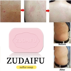 Zudaifu's 80g Pink Sulfur Soap: Deep Cleansing, Anti-Inflammatory, Antibacterial, Moisturizing, and Deodorizing - Ideal for Oily and Sensitive Skin