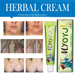 YIGANERJING 15g Herbal Cream | Treats Psoriasis, Eczema, and Psoriasis | Natural Herb Formula | Antibacterial, Soothes Itching, Repairs Skin, Ideal Cream for Skin Conditions