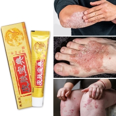 Yongzhi Zheng Herbal Antimicrobial Cream 15g - Soothing Relief for Psoriasis & Itchy Skin. Natural formula combats bacteria, gently treats skin