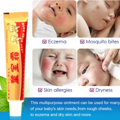 YIGANERJING Infant Soothing Cream - 15g, for baby's delicate skin. Relieves allergies, treats eczema, and dryness. Herbal formula ensures gentle care.