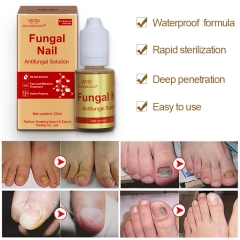 YIGANEJRING Antifungal Solution for Nail Fungus 20ML: Powerful Antimicrobial, Prevents Recurrence, Improves Nail Health, Long-lasting Care, Effective Solution for Nail Fungus.