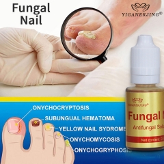 YIGANEJRING Antifungal Solution for Nail Fungus 20ML: Powerful Antimicrobial, Prevents Recurrence, Improves Nail Health, Long-lasting Care, Effective Solution for Nail Fungus.