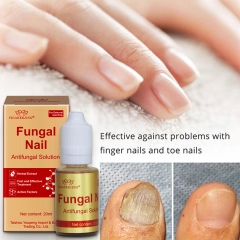 YIGANEJRING Antifungal Solution for Nail Fungus 20ML: Powerful Antimicrobial, Prevents Recurrence, Improves Nail Health, Long-lasting Care, Effective Solution for Nail Fungus.