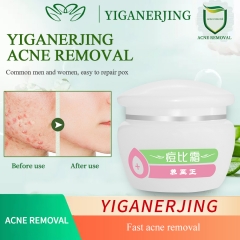 YANGZHIZHENG Acne Treatment Cream, Rapid Soothing and Repair, Refreshing Skin, 30g Portable Size. The Ideal Choice for Treating Acne Problems.