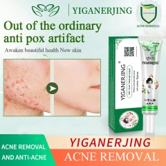 30g Yiganerjing Anti Acne Cream Chinese Herbal Pimples Blackhead Removal Cream Acne Treatment Gel